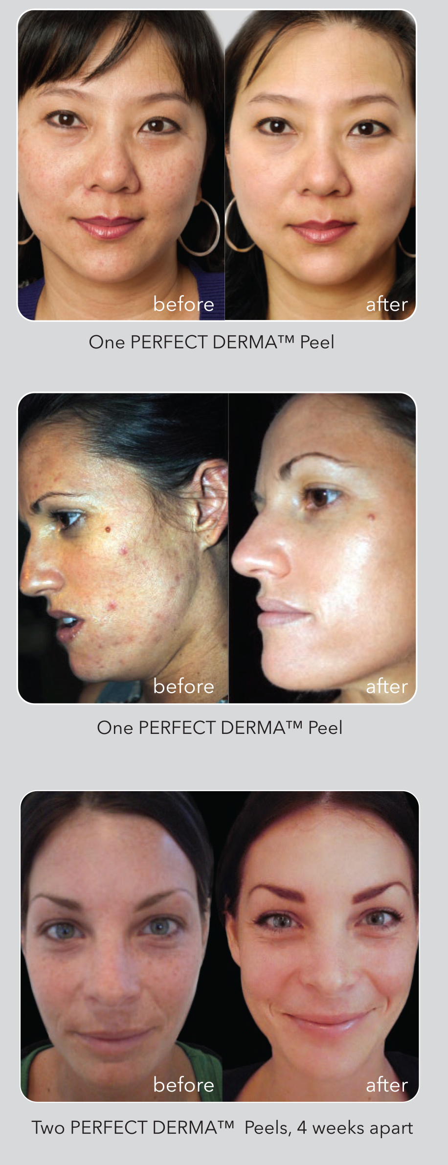derma-before-after